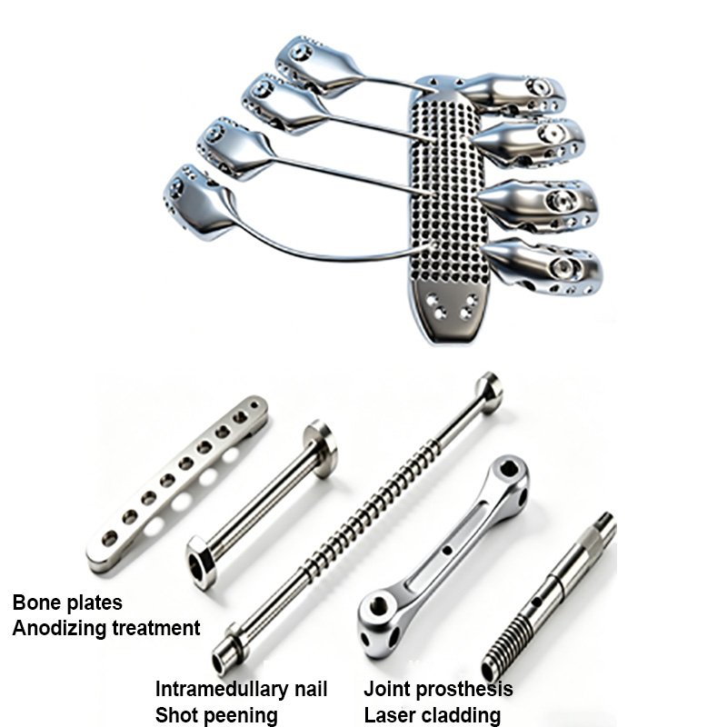 Bone plate, intramedullary nail, joint prosthesis 1777538258917044